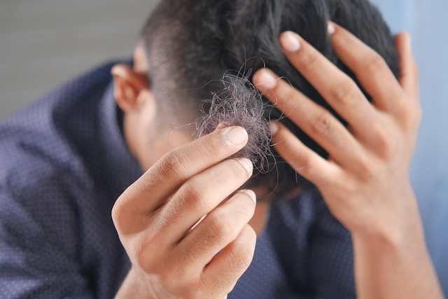 Causes Of Hair Loss And How To Treat Them